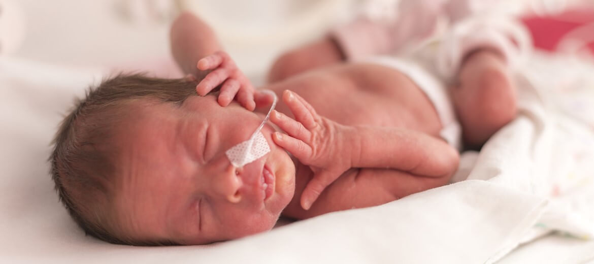 یک نوزاد کم وزن متولد شده از مادر مبتلا به کم خونی