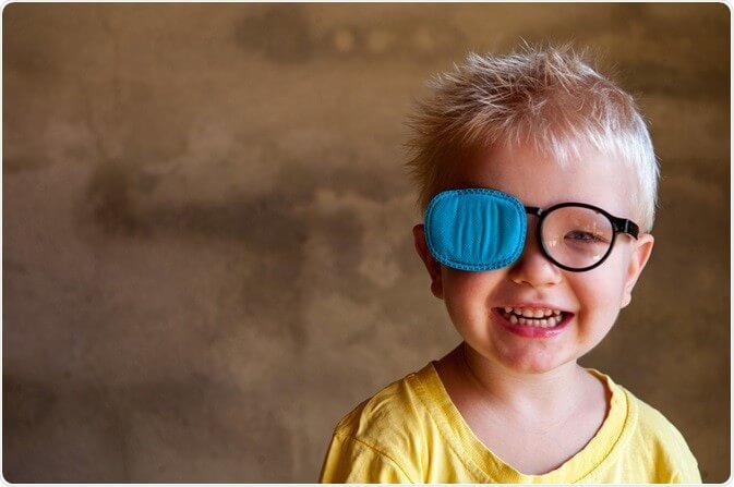 استفاده از چشم بند برای درمان تنبلی چشم کودک
