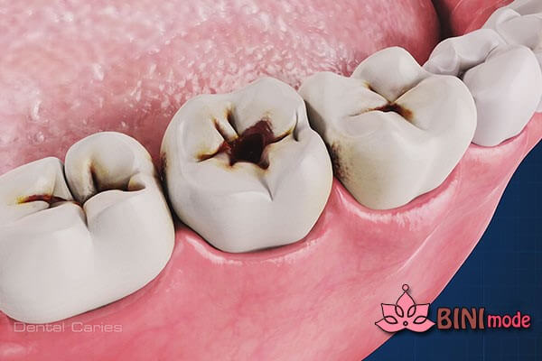 تاثیر ژل دنتول برای دندان درد