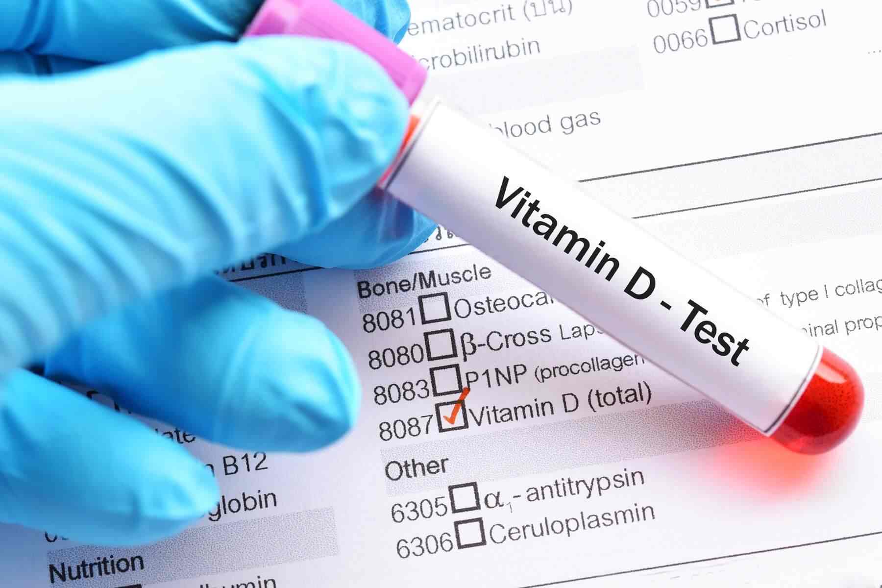 چک کردن ویتامین دی در بدن