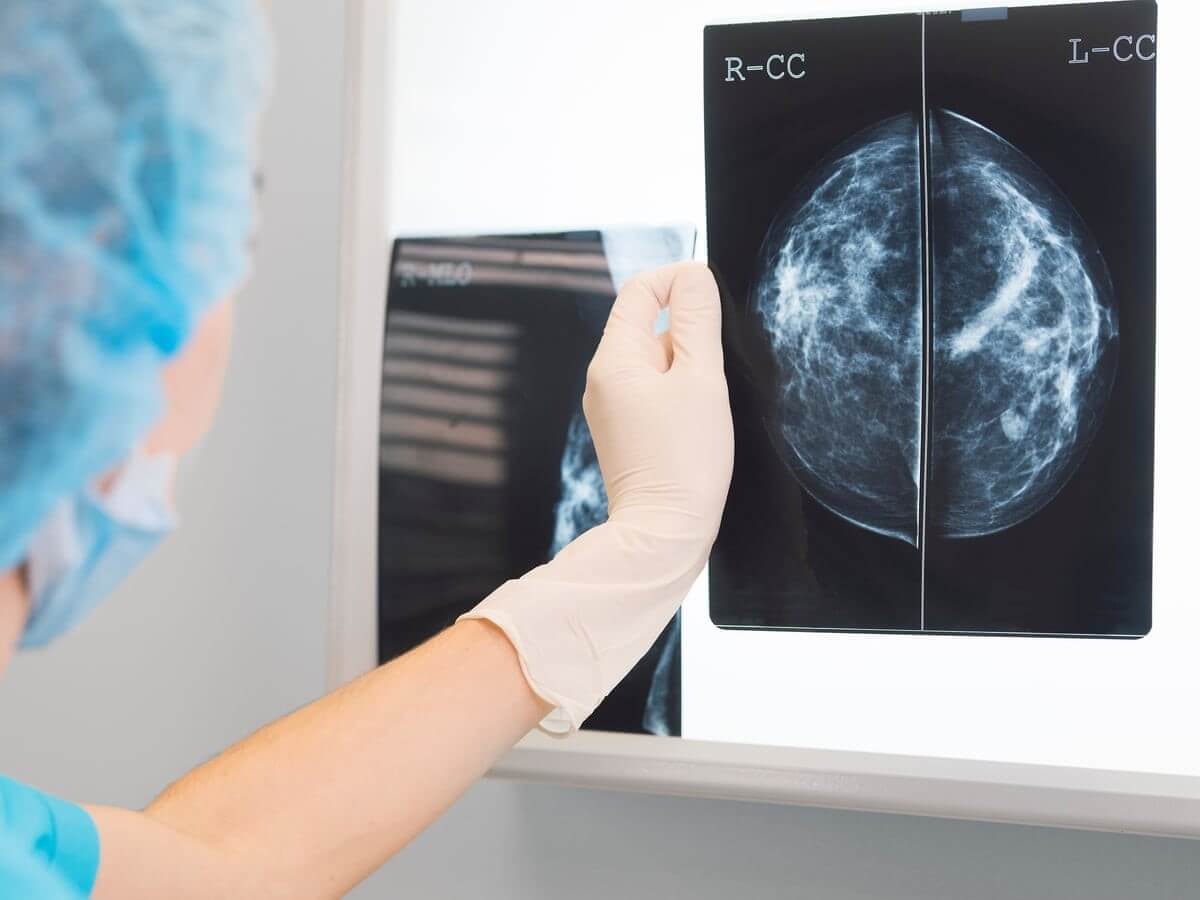بایدهای قبل از ماموگرافی