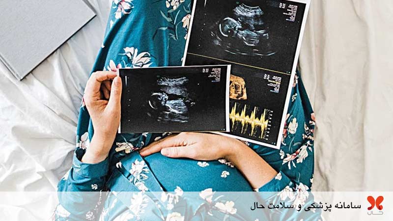 سونوگرافی هفته 31 بارداری برای چیست